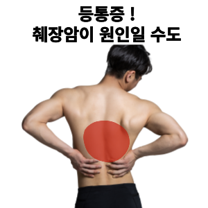 등통증 , 췌장암의 원인