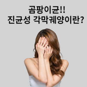 진균성 각막궤양 