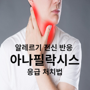 알레르기 전신반응 아나필락시스 응급처치법 