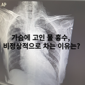가슴에 고인 물 흉수, 비정상적으로 차는 이유는? 