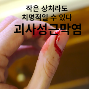 작은 상처라도 치명적일 수 있다 괴사성근막염