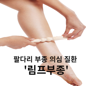 팔다리 부종 의심 질환 림프부종