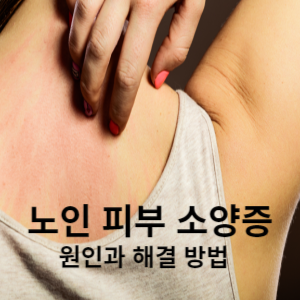 노인 피부 소양증 원인과 해결 방법 