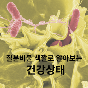 질분비물 색깔로 알아보는 건강상태