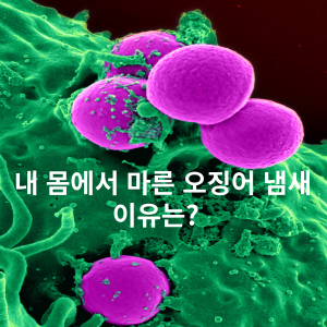 내 몸에서 마른 오징어 냄새 이유는? 