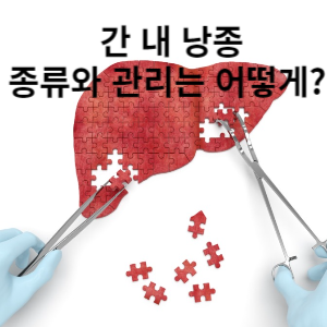 간 내 낭종 종류와 관리는 어떻게?