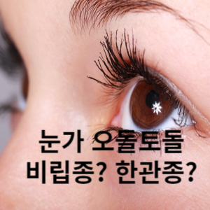 눈가 오돌토돌 비립종? 한관종?