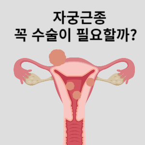 자궁근종 꼭 수술이 필요할까?