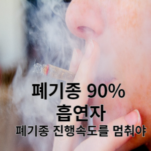 폐기종 90% 흡연자 폐기종 진행속도 멈춰야