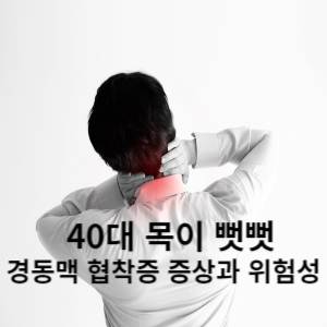 40대 목이 뻣뻣 경동맥 협착증 증상과 위험성