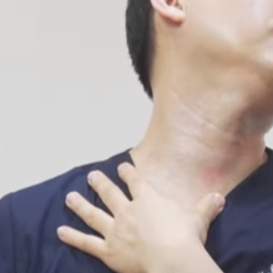 흉쇄유돌근 스트레칭하는 방법 이미지 