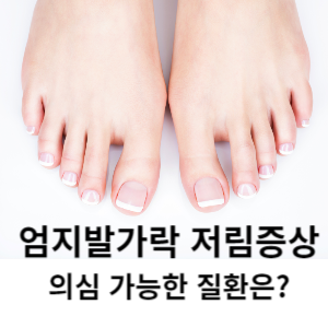 엄지발가락 저림증상 의심 가능한 질환은?