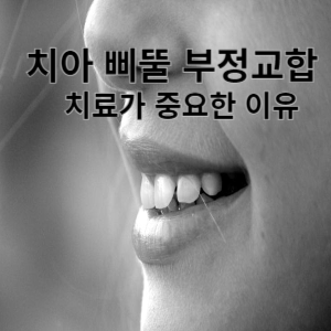 치아 삐뚤 부정교합 치료가 중요한 이유
