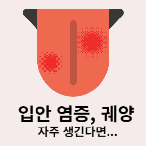 입안 염증, 궤양 자주 생긴다면