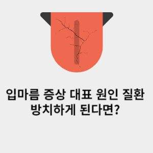 입마름 증상 대표 원인 질환 방치하게 된다면? 