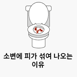 소변에 피가 섞여 나오는 이유