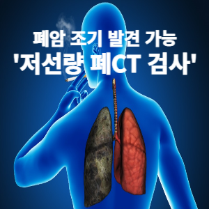폐암검진 저선량 폐CT 검사 준비사항 가뭄에 단비